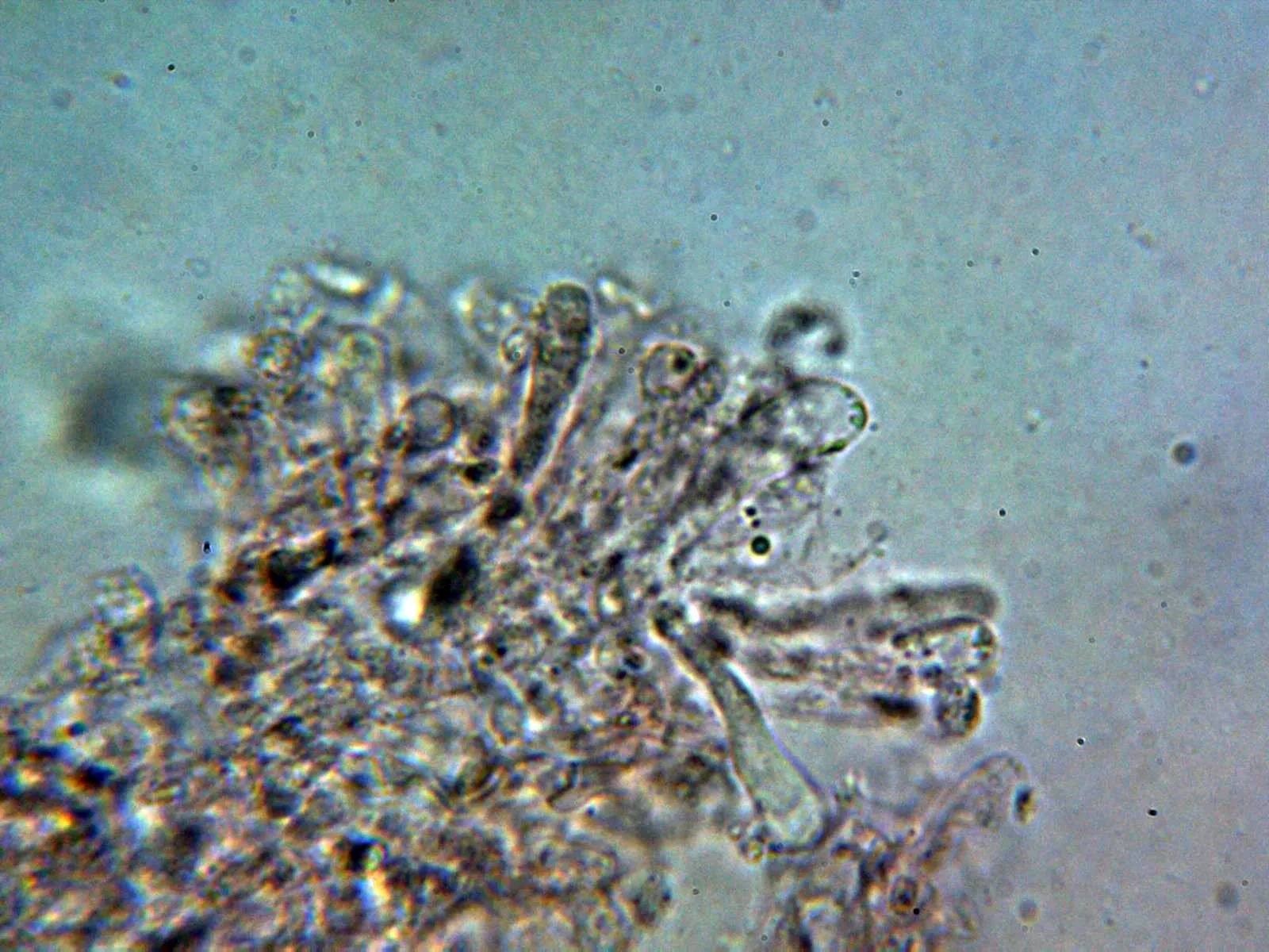 Microscopía de Leucocybe candicans - 10 - Arista laminar 2